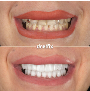 Image of Dentfix Turkey Gallery 0