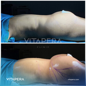 Image of Vitapera Clinic Gallery 2