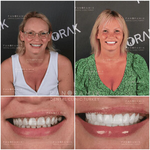 Image of Panoramik Dental Gallery 0