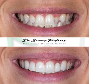 Image of Smile Makeover - Farfaras Dental Clinic