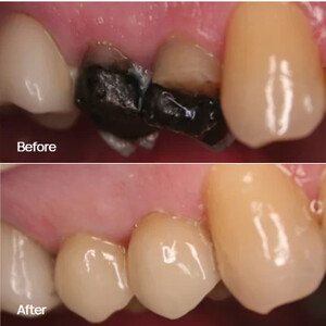 Image of Beechcroft Dental Practice Gallery 2