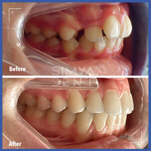 Image of SimyaDent Dental Clinic Gallery 0