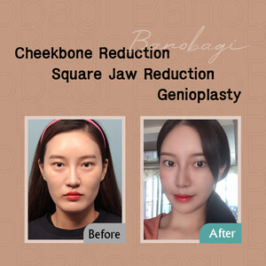 Image of Banobagi Plastic Surgery Clinic Gallery 0