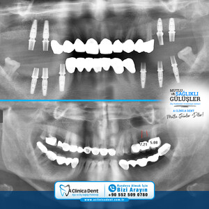 Image of A Clinica Dent Gallery 3