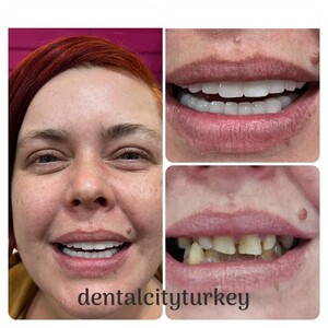 Image of Dental City Turkey Gallery 2