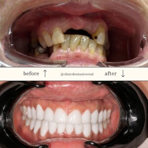 Image of Hollywood Smile