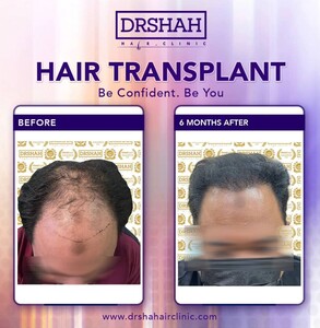 Image of Dr Shah Specialist Hair Loss Clinic Gallery 3