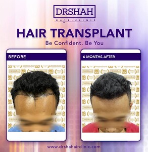 Image of Dr Shah Specialist Hair Loss Clinic Gallery 1