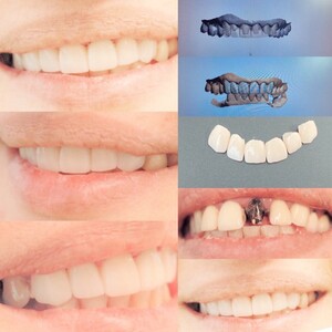 Image of Digital smile design - DentalARIA