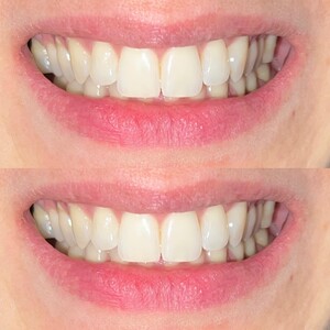 Image of Croatia Dental Care Gallery 0