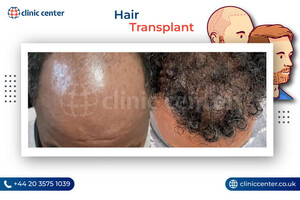 Image of Clinic Center - Hair Transplant Clinic Turkey Gallery 0