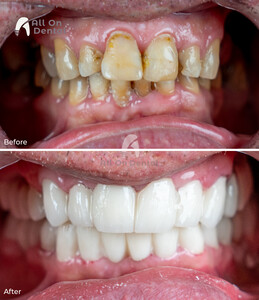 Image of All On Dental Clinic Istanbul Gallery 2