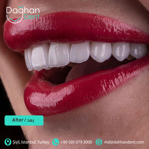 Image of Dağhan Dent VIP Clinic Gallery 0