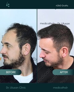 Image of Dr. Sibel Ulusan Medical Hair Clinic Gallery 2