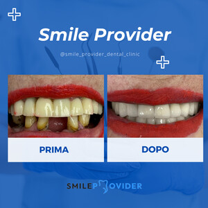 Image of Smile makeover - Smile Provider