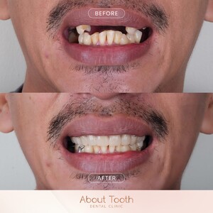 Image of About Tooth Dental Clinic Gallery 2