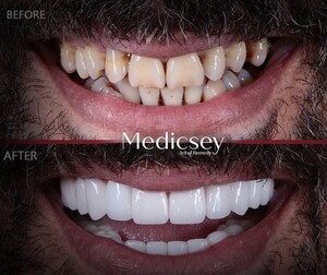 Image of Hollywood smile