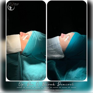 Image of Op Dr Burak Demirel ENT and Facial Aesthetics Clinic Gallery 3