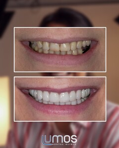 Image of Lumos  Dental Clinic Gallery 2