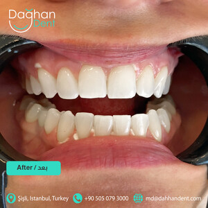 Image of Dağhan Dent VIP Clinic Gallery 3