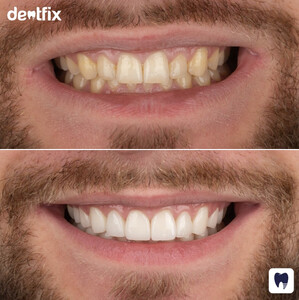 Image of Dentfix Turkey Gallery 2