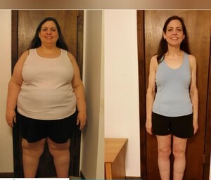 Image of Before and after weight loss