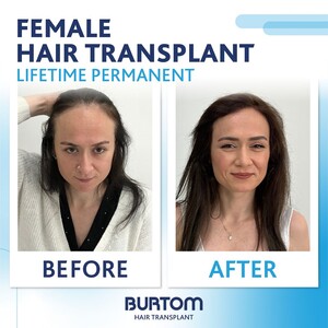 Image of Burtom Hair Transplant Center Gallery 1