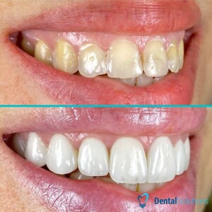 Image of Dental Solutions Gallery 3