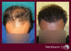 Image of Bergmann Kord Hair Clinic Gallery 1