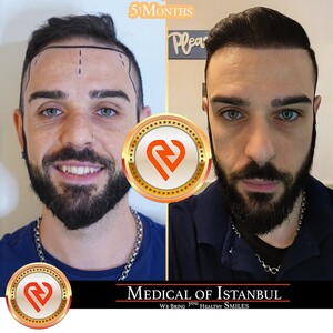 Image of Medical of Istanbul HairTransplant Gallery 0