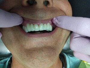 Image of Smile makeover