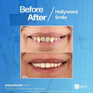 Image of Ankyra Dental Gallery 3