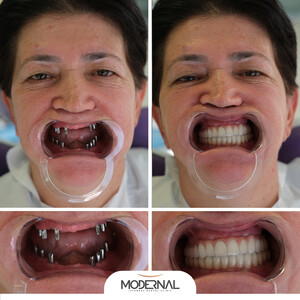 Image of Modernal Dental Clinic Gallery 2