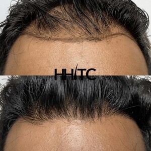 Image of Houston Hair Transplant Center - Dr. Goran Jezic Gallery 3