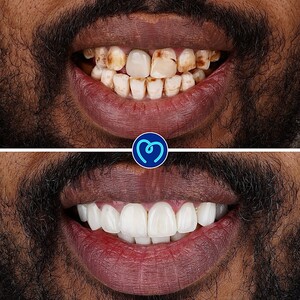 Image of Smile makeover