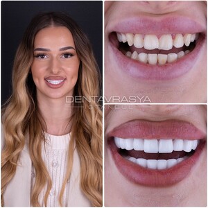 Image of Dentavrasya Dental Clinic Istanbul Turkey Gallery 1