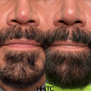 Image of Houston Hair Transplant Center - Dr. Goran Jezic Gallery 1