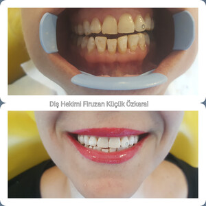 Image of Konyaaltı Dental Clinic Gallery 0