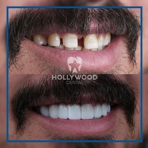 Image of Hollywood Dental Izmir Gallery 3