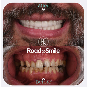 Image of Road to Smile Gallery 0