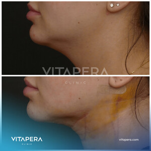 Image of Vitapera Clinic Gallery 1