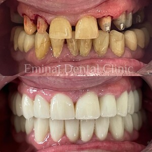 Image of Eminaj Dental Clinic Gallery 1