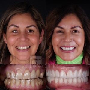 Image of Dental Excellence Turkey Gallery 3