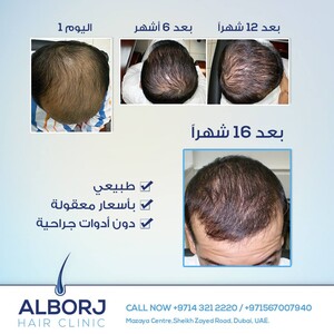 Image of AlBorj Hair Clinic Gallery 1