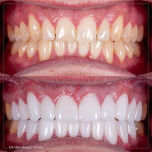 Image of Dental Design Turkey Gallery 2