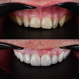 Image of Creative Smiles Turkey (CS) Dental Clinic Gallery 3