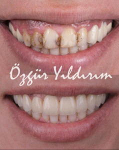 Image of Özgür Yıldırım Aesthetic Dental Clinic Gallery 0