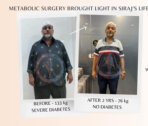 Image of Metabolic surgery