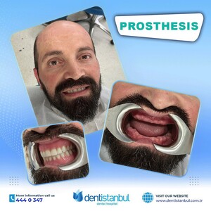 Image of Dentistanbul Dental Hospital Gallery 3