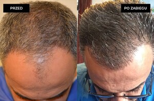 Image of Dr. Pyziak Hair Transplant Center Gallery 1